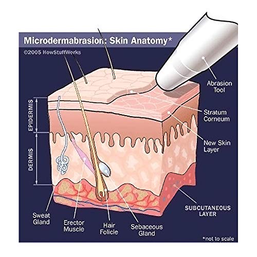 NeedCrystals mikrodermoabrazija kristali za mašine, potpuno prirodni tretman pilinga lica za dosadnu ili suhu kožu, bore, fleke, ožiljke & više