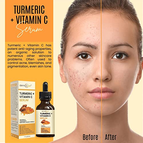 Serum za lice od kurkume + Vitamin C, organska hidratantna krema, jasan ton kože, hidrirajte dosadnu i suhu kožu ,Serum za lice protiv starenja -