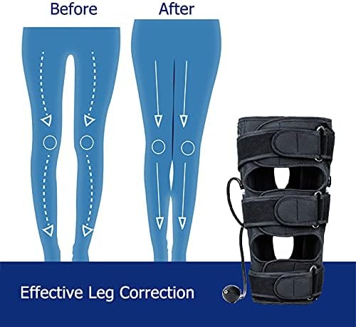 ALUCE O / X korekcijski pojas za korekciju pojasa, pojas za korekciju trake za korekciju Knock Knees Valgus Deformity luk noge traka za ispravljanje pojasa trajni ronilački materijal
